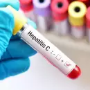 Ocho de cada diez pacientes con hepatitis C no saben que la tienen
