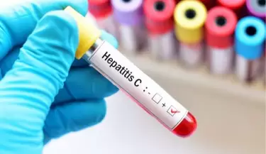 hepatitis