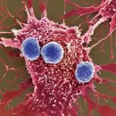 Un nuevo caso de c�ncer cada cuatro minutos se diagnostica en la Argentina