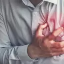 Se registran 40 mil infartos al a�o en Argentina y preocupa la mayor incidencia en
j�venes