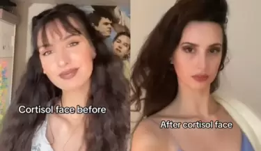 cara de cortisol