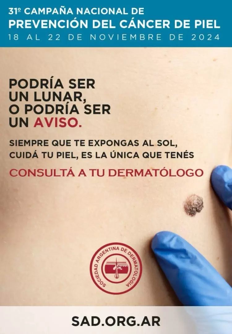 piel