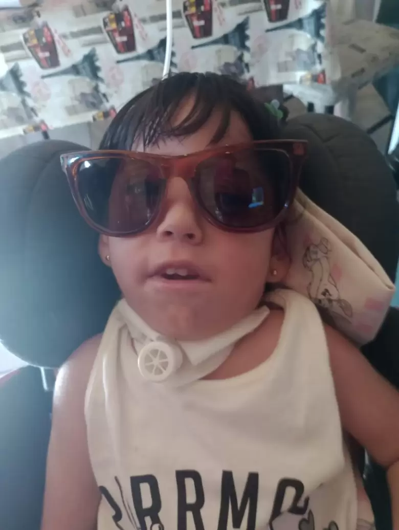 CASO ALESA