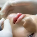 Cada vez m�s mujeres menores de 40 se hacen cirug�as de rejuvenecimiento facial