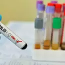 S�filis en aumento: una curva ascendente que alerta a la salud p�blica