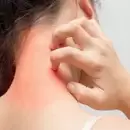 Anafilaxia: una de las reacciones más severas en el foco del Día Mundial de la Alergia