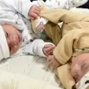 Recibieron el alta los bebes gemelos que fueron operados dentro del útero