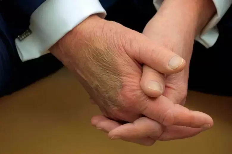 trump enfermedad