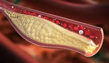 colesterol