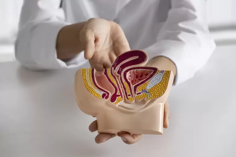 vasectomia