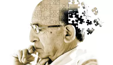 alzheimer