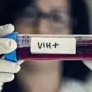 Organizaciones alertan que el ajuste de Milei pone en riesgo los tratamientos de VIH