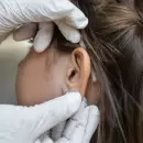 En el Día Mundial de la Audición, Salud reforzará controles auditivos en la primera infancia